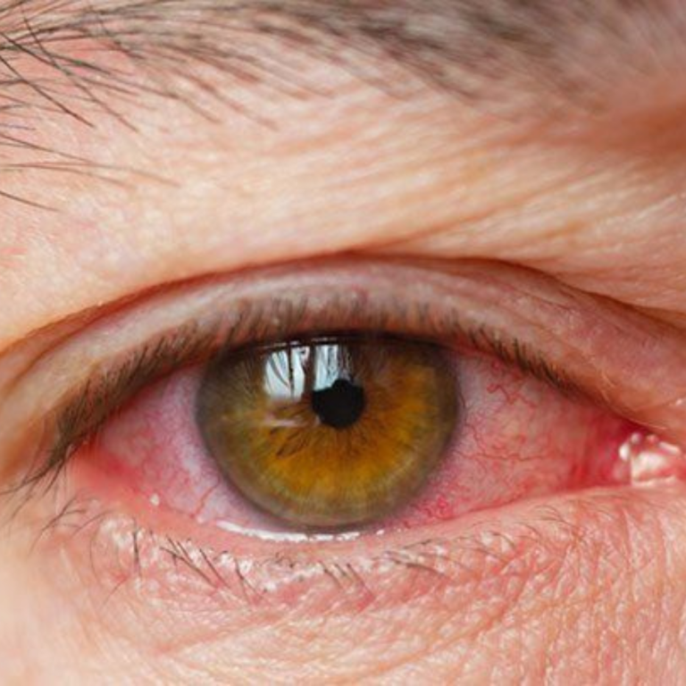 eye clinic mira bhayandar