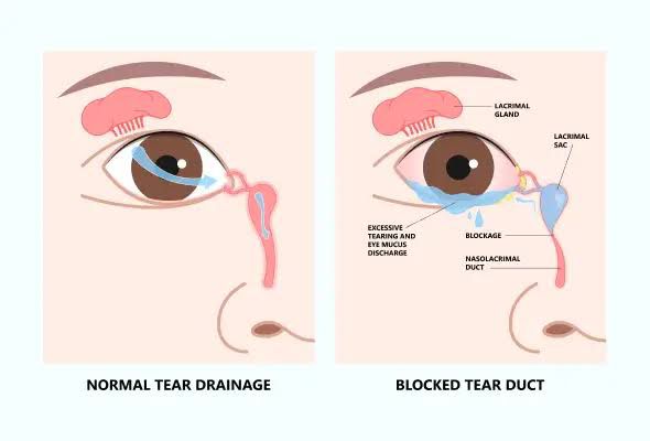 eye clinic mira bhayandar
