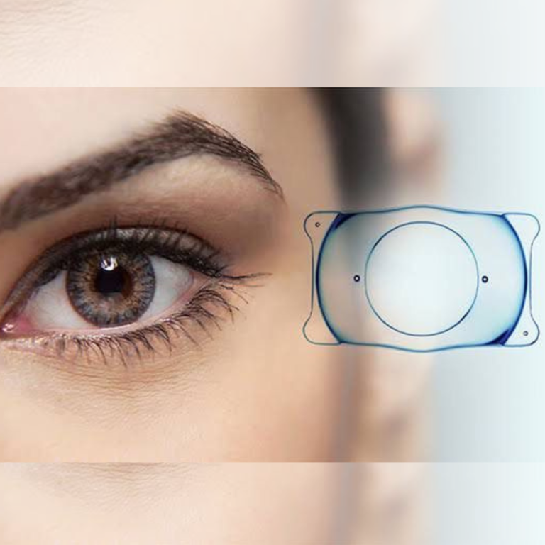 eye clinic mira bhayandar