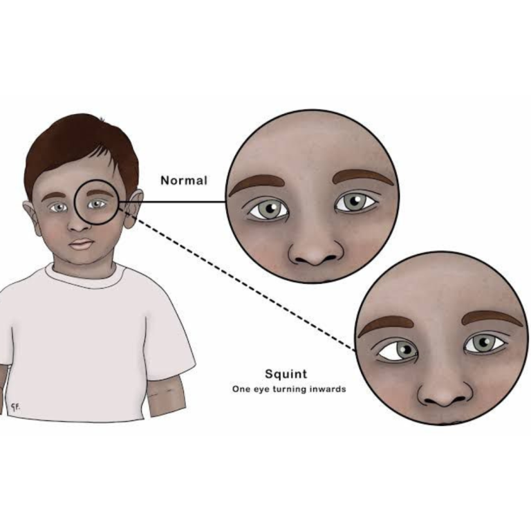eye clinic mira bhayandar
