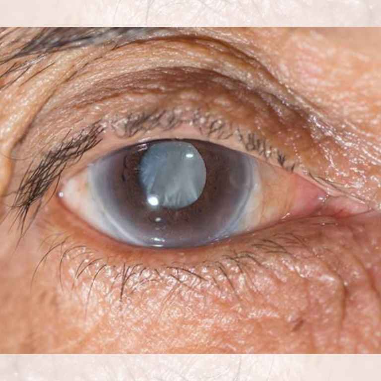 eye clinic mira bhayandar