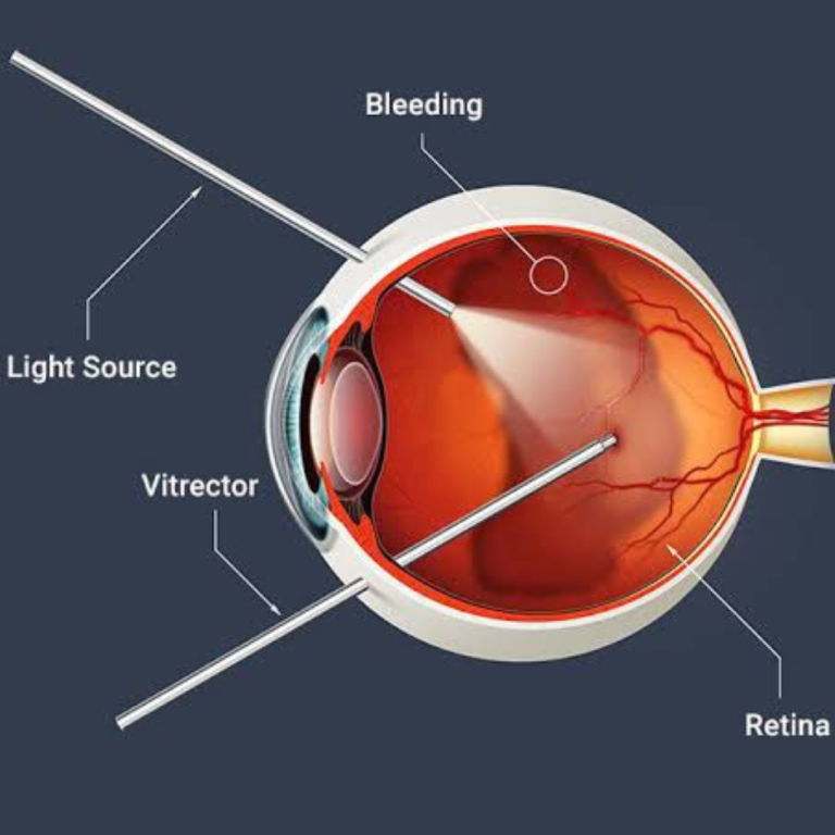 eye clinic mira bhayandar